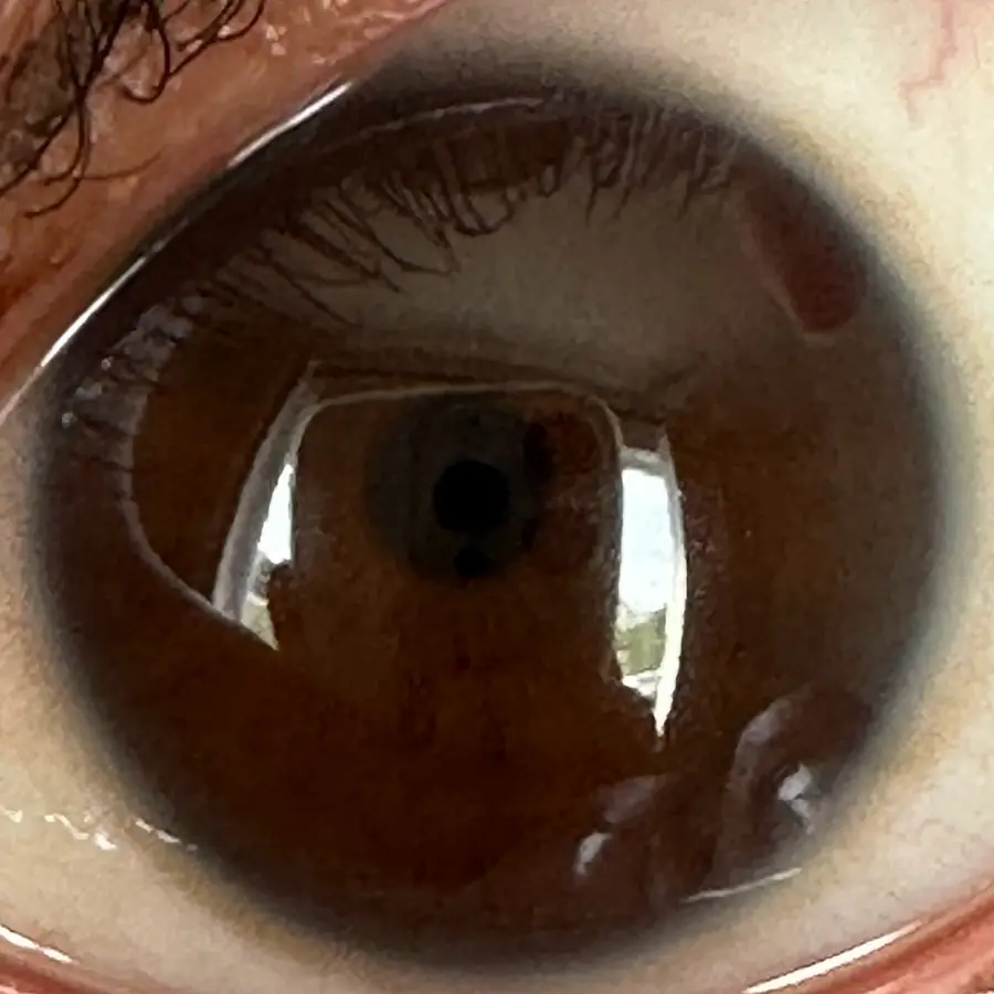 Example: the iPhone close-up it started from